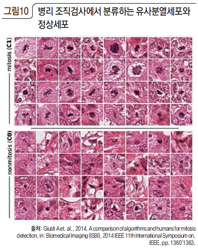 그림10 병리 조직검사에서 분류하는 유사분열세포와 정상세포