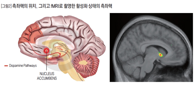 [그림2] 측좌핵의 위치, 그리고 fMRI로 촬영한 활성화 상태의 측좌핵