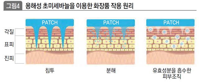 용해성 초미세바늘을 이용한 화장품 작용 원리