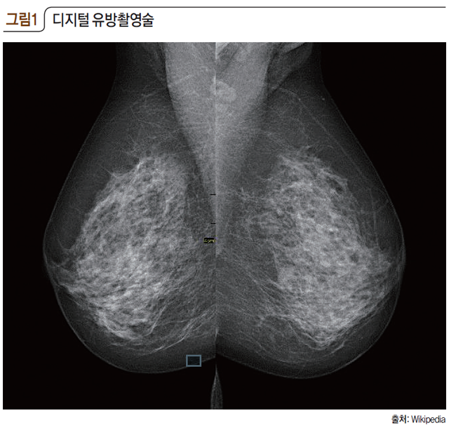 그림1 디지털 유방촬영술