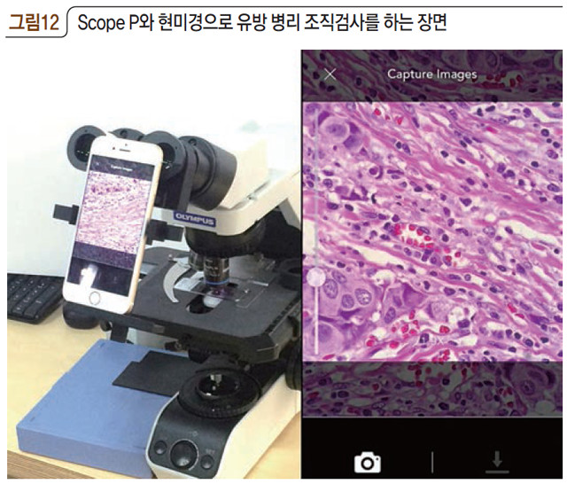 그림12 Scope P와 현미경으로 유방 병리 조직검사를 하는 장면