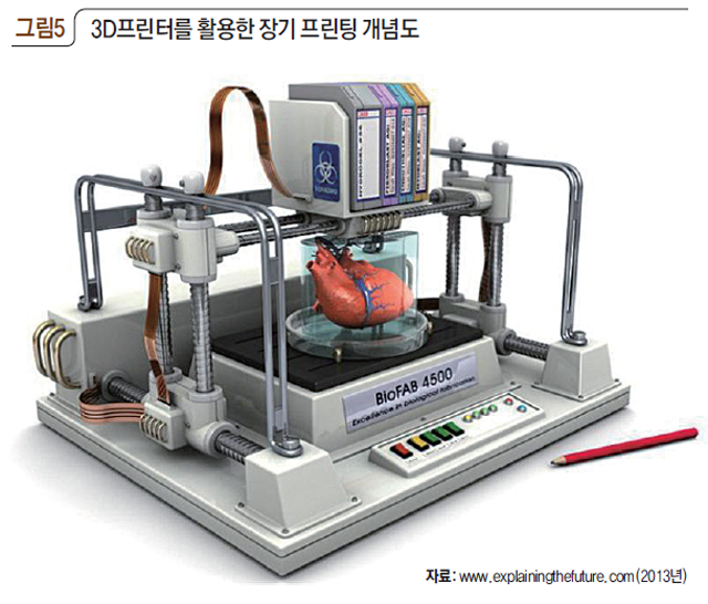 3D프린터를 활용한 장기 프린팅 개념도