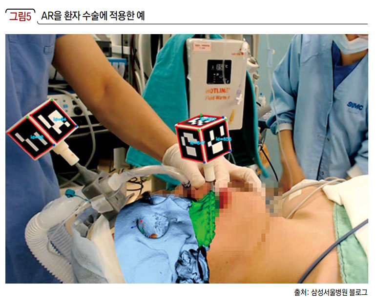 AR을 환자 수술에 적용한 예