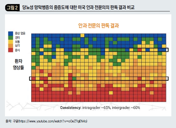 당뇨성 망막병증의 중증도에 대한 미국 안과 전문의의 판독 결과 비교