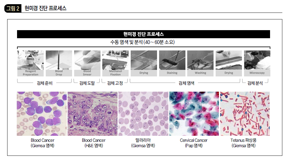 현미경 진단 프로세스 