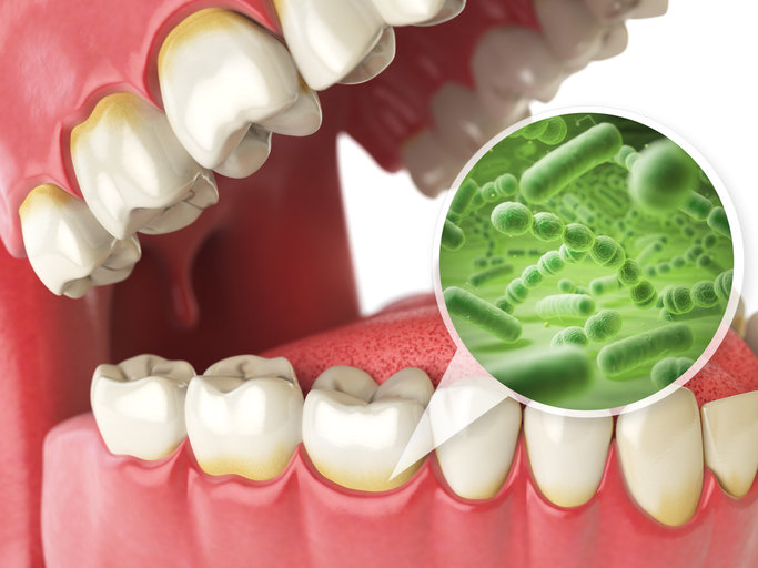 "Oral Bacteria Triple Pancreatic Cancer Risk"