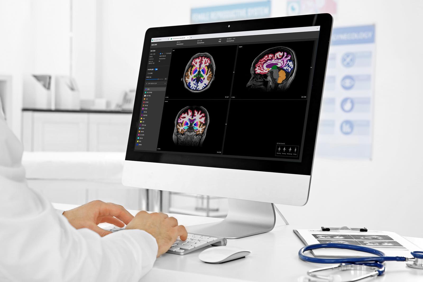 "GIST Lab-Born K-Deep Tech Startup Eyes Global Stage"