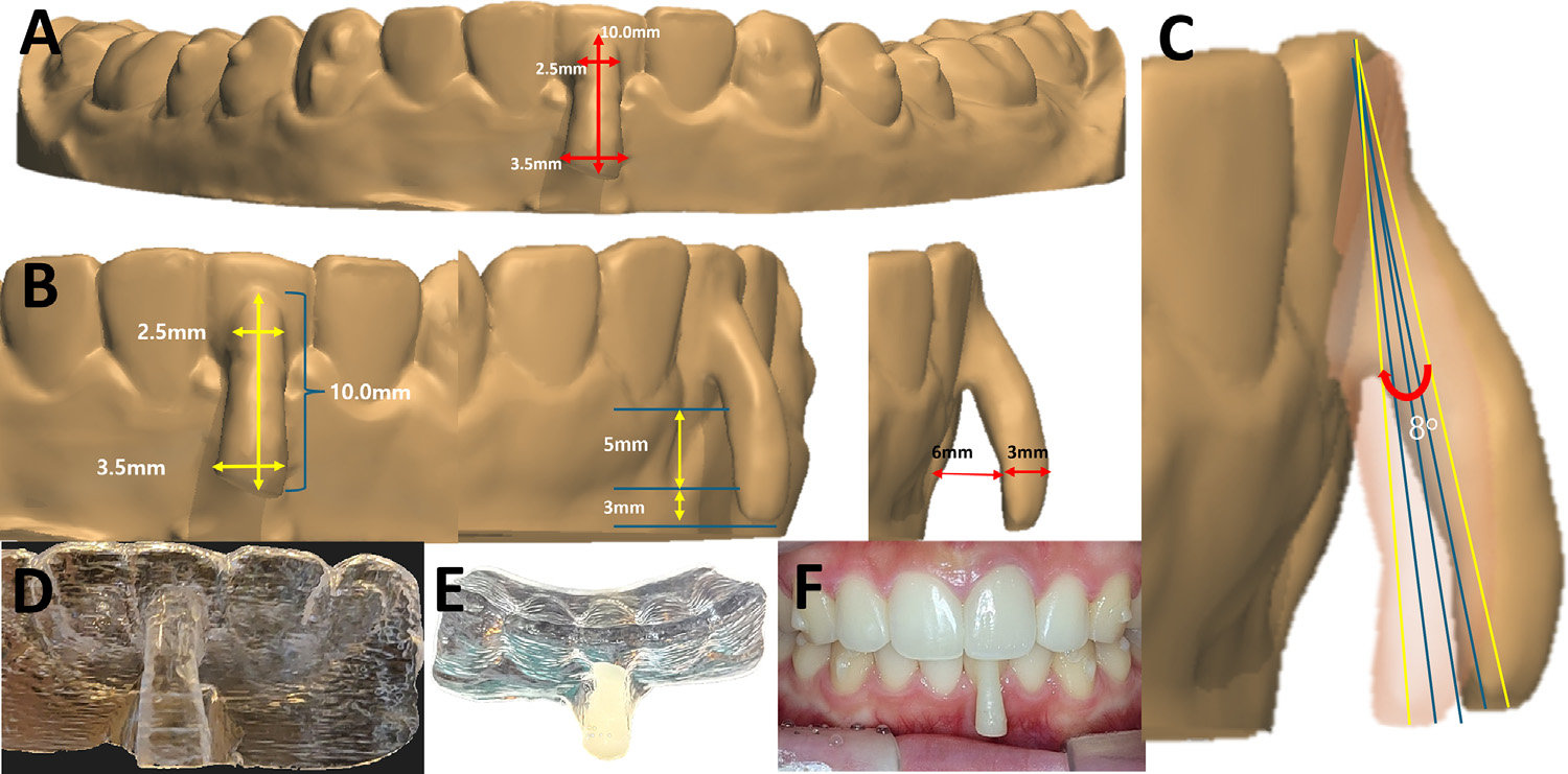 Sisrutech CEO Publishes Gum Treatment Paper in AJO-DO