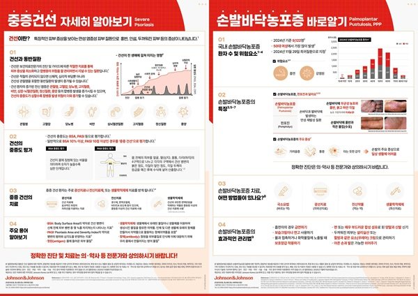 Infographics Released for Severe Psoriasis Awareness Day