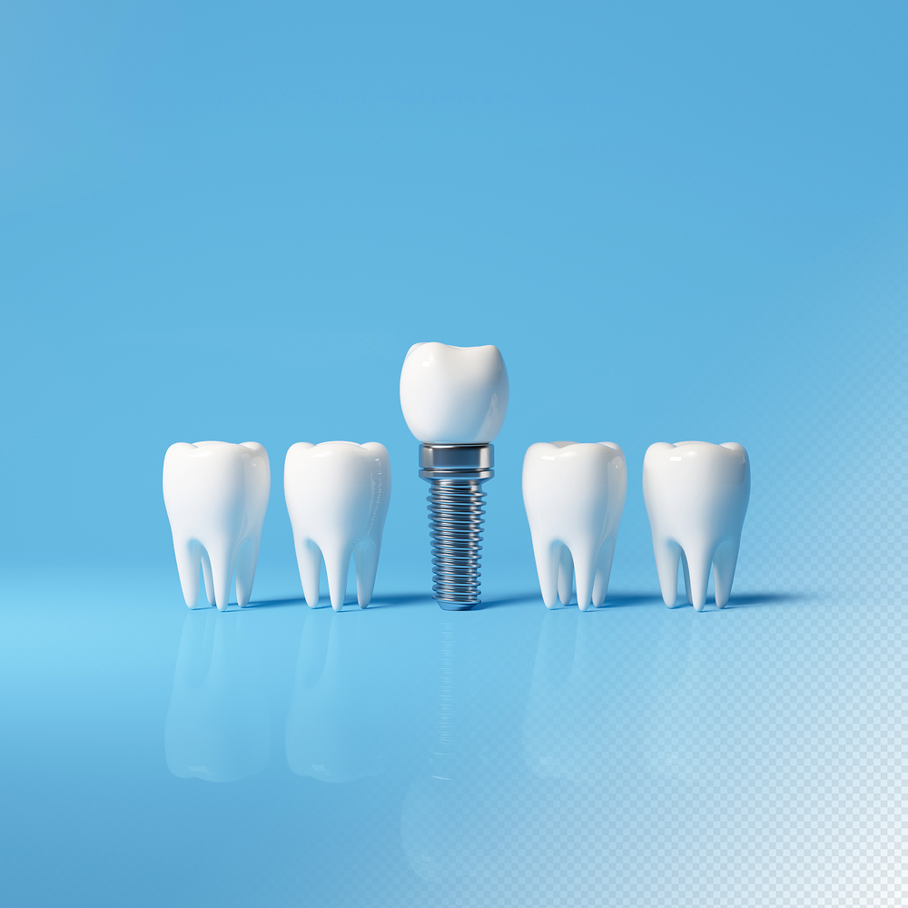 KRW 100 Billion Implant Plant Planned in Wonju