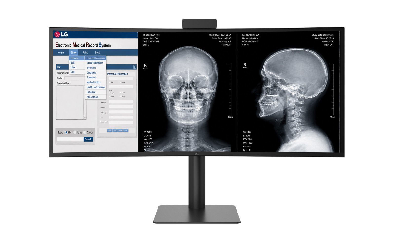 LG Electronics Targets B2B Medical Monitor Market After U.S. FDA Approval