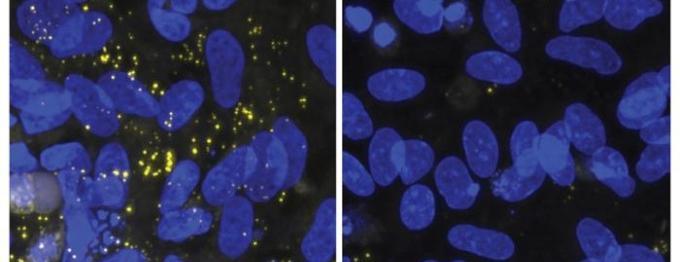 Drug Method Restores Brain Nerve Shield in Alzheimer’s